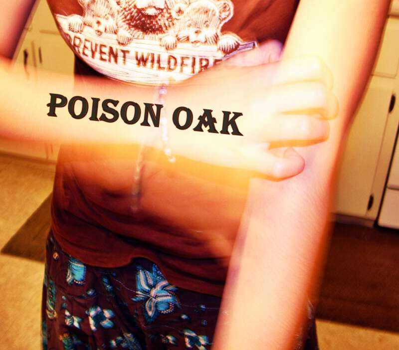 remedies for poison oak